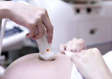 妊娠纹物理检查方法